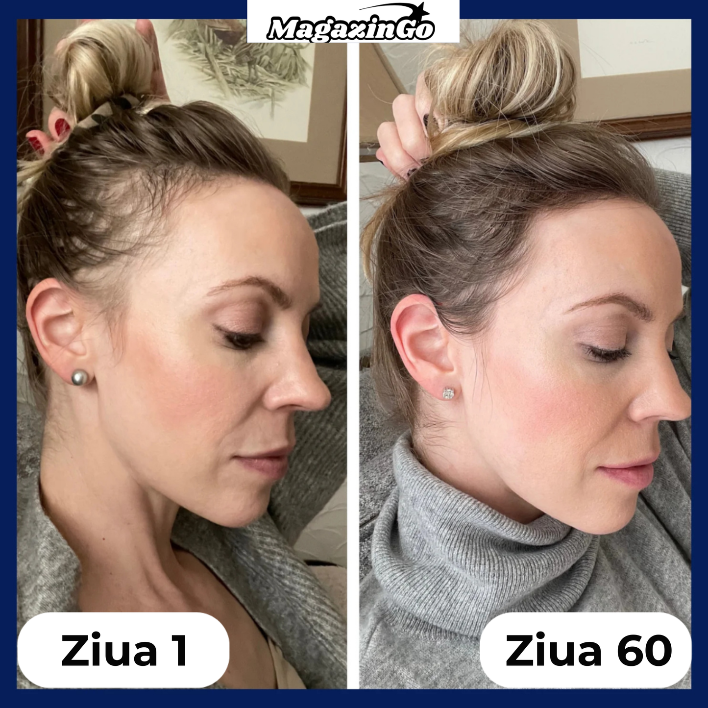 Sistemul cu bilă aplicatoare pentru păr