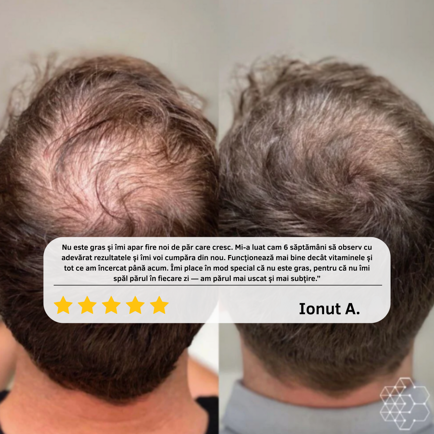 Sistemul cu bilă aplicatoare pentru păr